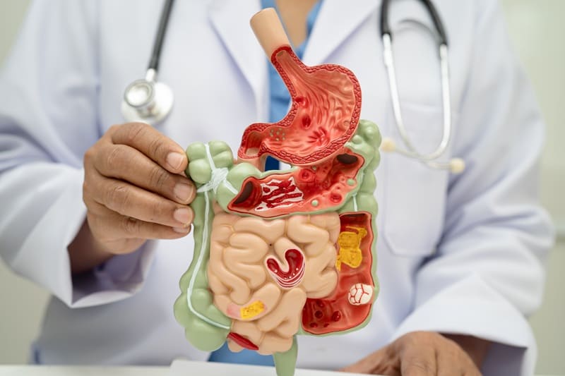 Cirugía por apéndice en Benito Juárez, CDMX